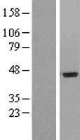 IL20 Receptor alpha (IL20RA) Human Over-expression Lysates NM_014432