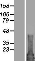 RAB4B Human Over-expression Lysates NM_016154
