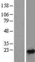 RAB24 Human Over-expression Lysates NM_001031677