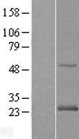 RAB24 Human Over-expression Lysates NM_130781