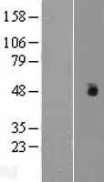 CSNK1G1 Human Over-expression Lysates NM_022048