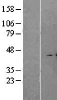 A4GALT Human Over-expression Lysates NM_017436