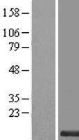 SMIM11A Human Over-expression Lysates NM_001042401