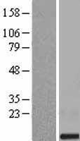 SMIM11A Human Over-expression Lysates NM_058182