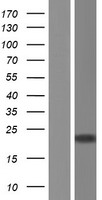 DNA Polymerase epsilon (POLE3) Human Over-expression Lysates NM_017443