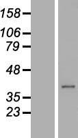ls054149 c21orf91 human over expression lysates nm 017447 wb testing 2