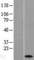 Cytochrome C (CYCS) Human Over-expression Lysates NM_018947