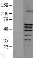 ERRFI1 Human Over-expression Lysates NM_018948