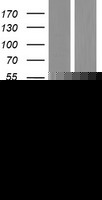 GDAP1 Human Over-expression Lysates NM_018972