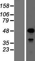 SOX18 Human Over-expression Lysates NM_018419