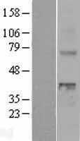 WNT4 Human Over-expression Lysates NM_030761
