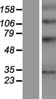 YIPF1 Human Over-expression Lysates NM_018982