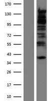 ls054439 rbm27 human over expression lysates nm 018989 wb testing 1
