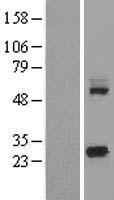 ls054442 kctd5 human over expression lysates nm 018992 wb testing 1