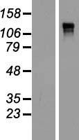 Anillin (ANLN) Human Over-expression Lysates NM_018685