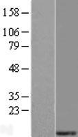 MRPS21 Human Over-expression Lysates NM_031901