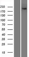 XRN1 Human Over-expression Lysates NM_019001