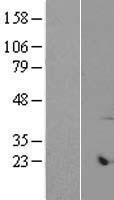 ls054470 armcx6 human over expression lysates nm 001009584 wb testing 2