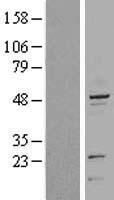 Cytokeratin 20 (KRT20) Human Over-expression Lysates NM_019010