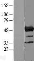 NLE1 Human Over-expression Lysates NM_018096