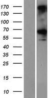 CCDC76 (TRMT13) Human Over-expression Lysates NM_019083