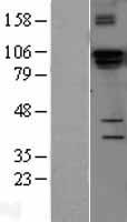 DGCR8 Human Over-expression Lysates NM_022720