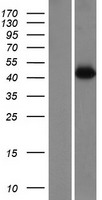 OTULINL Human Over-expression Lysates NM_019018