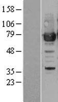 PRMT7 Human Over-expression Lysates NM_019023