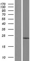 TMCO1 Human Over-expression Lysates NM_019026