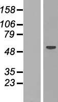 RBM47 Human Over-expression Lysates NM_019027