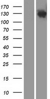 DHX29 Human Over-expression Lysates NM_019030