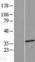 ls054511 hmgcll1 human over expression lysates nm 001042406 wb testing 1