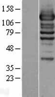 WDR44 Human Over-expression Lysates NM_019045