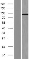 CCHCR1 Human Over-expression Lysates NM_019052