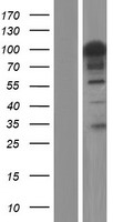 ls054540 fam193b human over expression lysates nm 001190946 wb testing 1
