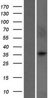 WDR5B Human Over-expression Lysates NM_019069
