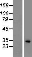ls054557 sgtb human over expression lysates nm 019072 wb testing 1