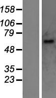 UGT1A10 Human Over-expression Lysates NM_019075