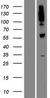 UGT1A8 Human Over-expression Lysates NM_019076