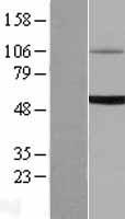 UGT1A6 Human Over-expression Lysates NM_001072
