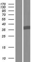 GNB1L Human Over-expression Lysates NM_053004