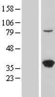 ls054585 lztfl1 human over expression lysates nm 020347 wb testing 1