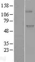 UGT (UGT1A9) Human Over-expression Lysates NM_021027