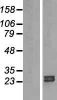 ARL15 Human Over-expression Lysates NM_019087