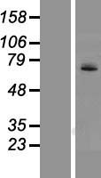UGT1A4 Human Over-expression Lysates NM_007120