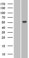 UGT1A3 Human Over-expression Lysates NM_019093