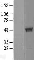 TBC1D13 Human Over-expression Lysates NM_018201
