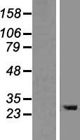 TMEM106B Human Over-expression Lysates NM_018374