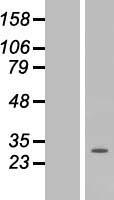 CRLS1 Human Over-expression Lysates NM_019095