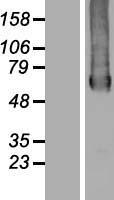 GTPBP2 Human Over-expression Lysates NM_019096